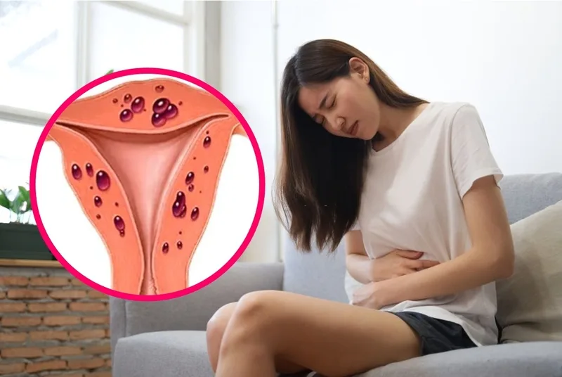 Đau bụng bên trái ở nữ là bệnh gì