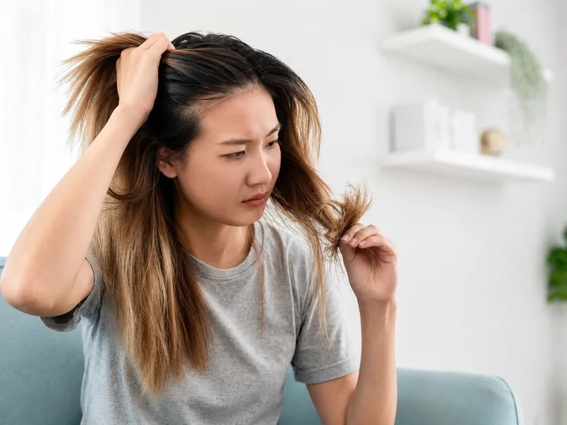 Rụng tóc thành mảng, ngứa đỏ hoặc kéo dài là dấu hiệu nên được bác sĩ da liễu đánh giá sớm.